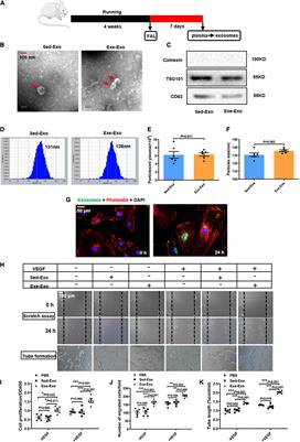 Prophylactic exercise-derived circulating exosomal miR-125a-5p promotes endogenous revascularization after hindlimb ischemia by targeting endothelin converting enzyme 1